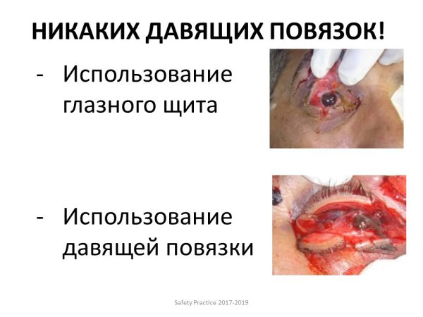 Глазной щит — изображение 2