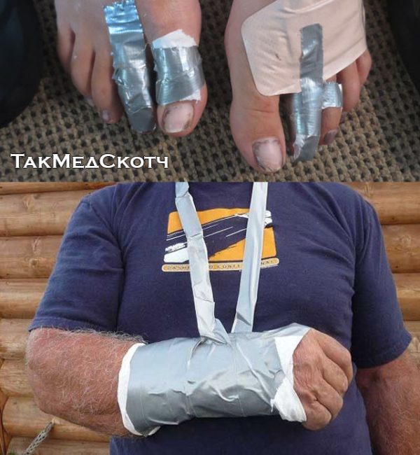 Армированный ТакМедСкотч — изображение 3